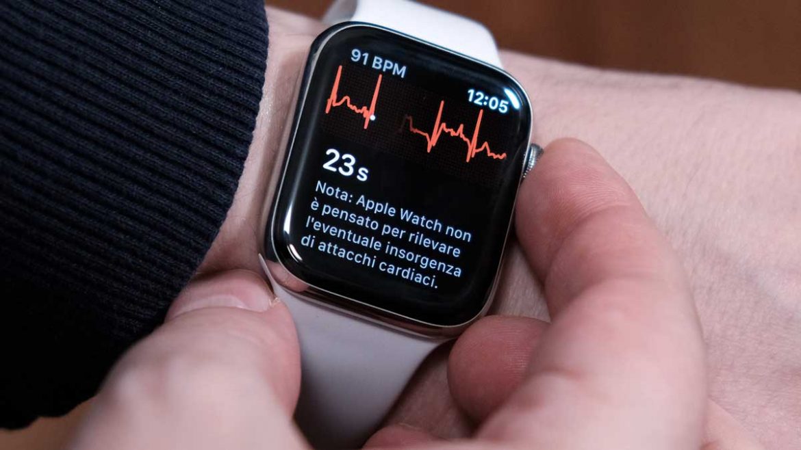 apple watch ecg