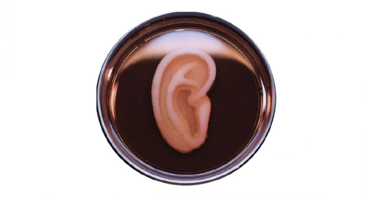 orecchio bionico stampato in 3d